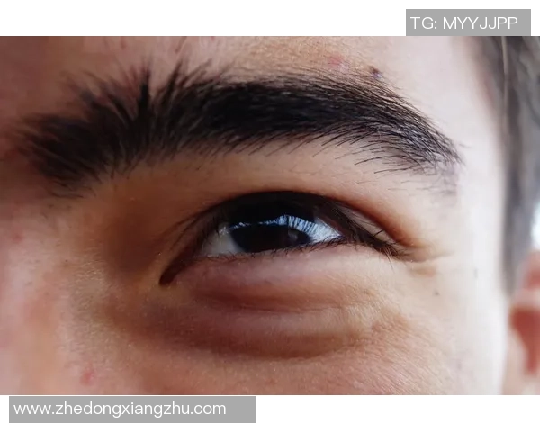 足球球星眼袋背后的秘密 揭示运动员压力与睡眠的重要性